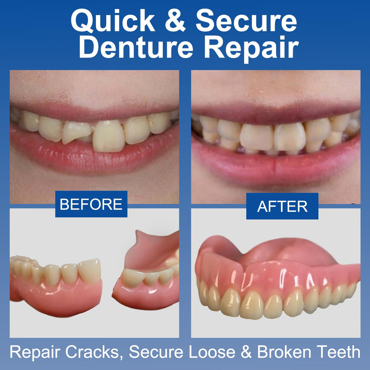 1 oz Clear Dental Bonding Glue N206