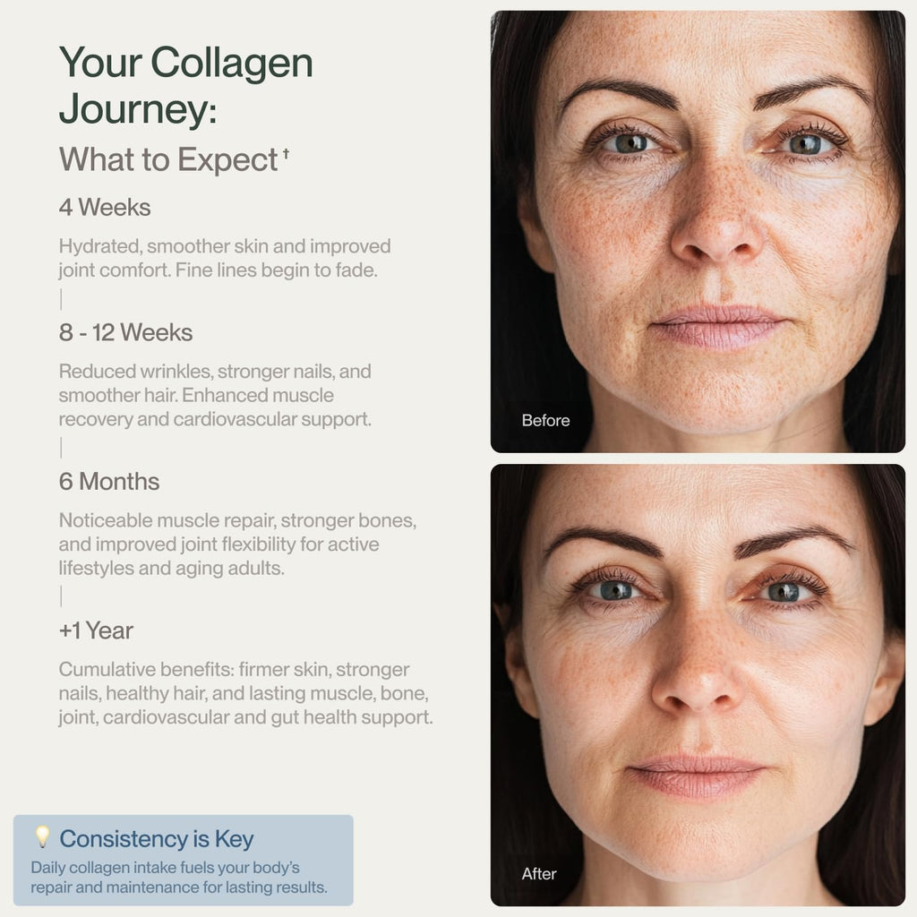 Collagen Peptides Powder Grass-Fed Pasture-Raised Hydrolyzed Type I & III Unflavored 32 oz Z590343