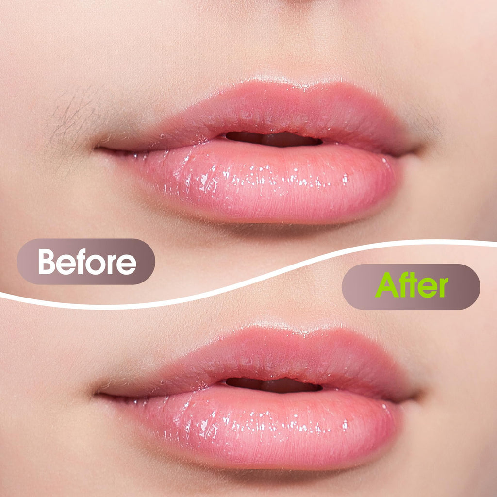 Electric Facial Hair Removal Device for Women S127000